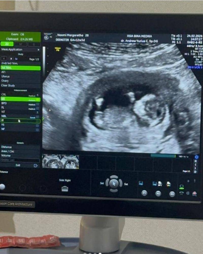 Instagram.com/Bene_dion